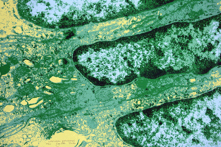 Cytoplasmic Exploration<BR>1982<BR>23in x 27in<BR>White Paper<BR>Colors: 5<BR>Number Produced: 67<BR>$80